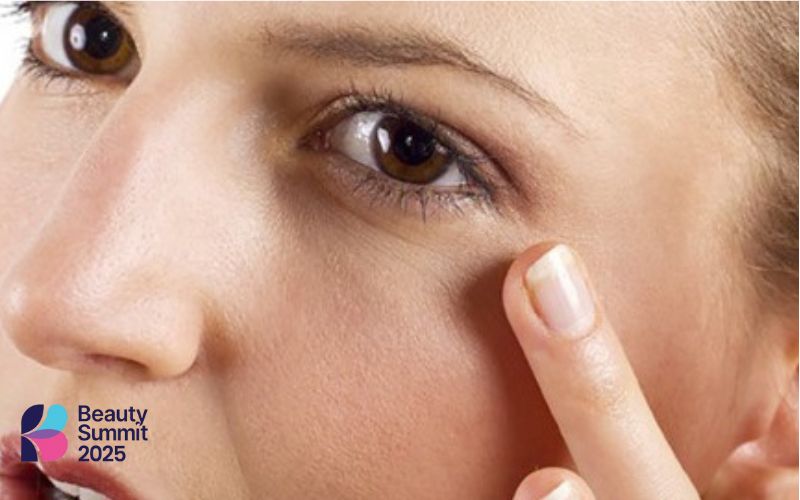 Dấu hiệu da mắt bị lão hóa vết châm chim Dấu hiệu da mắt bị lão hóa vết châm chim
