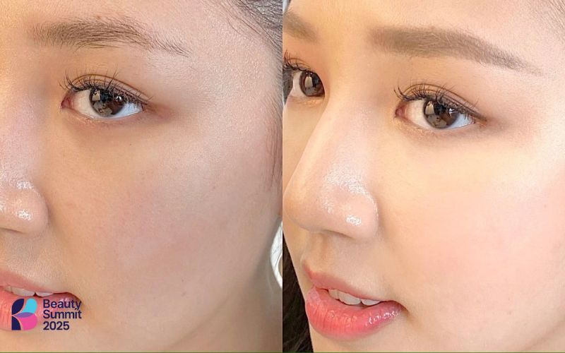 Cách xử lý khi bôi kem chống nắng bị xỉn màu