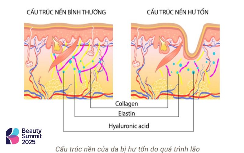 Collagen và elastin giúp giữ cấu trúc và độ đàn hồi của da Collagen và elastin giúp giữ cấu trúc và độ đàn hồi của da