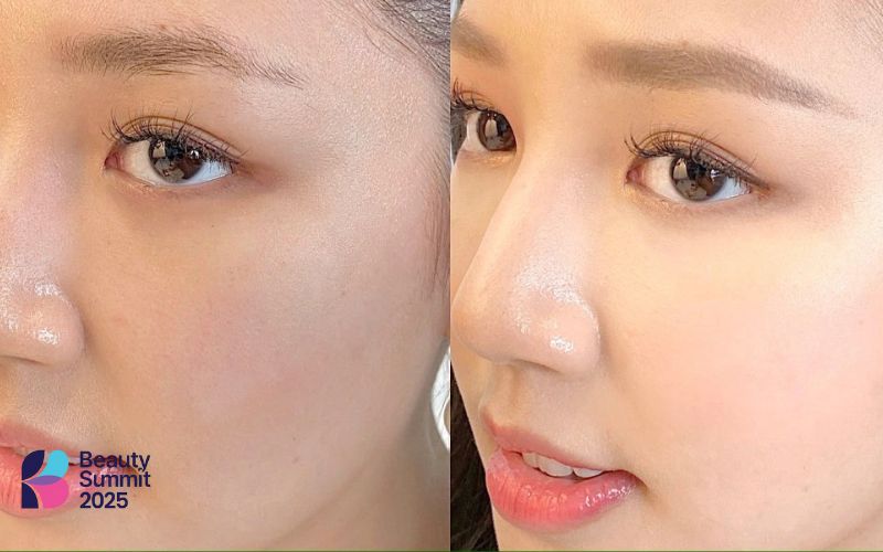 Da bị kích ứng thì không nên sử dụng kem chống nắng