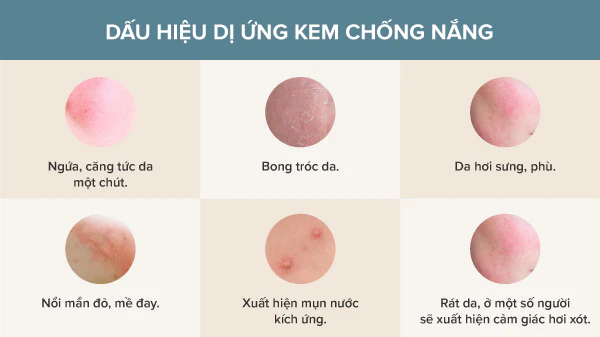 di ung kem chong nang 1