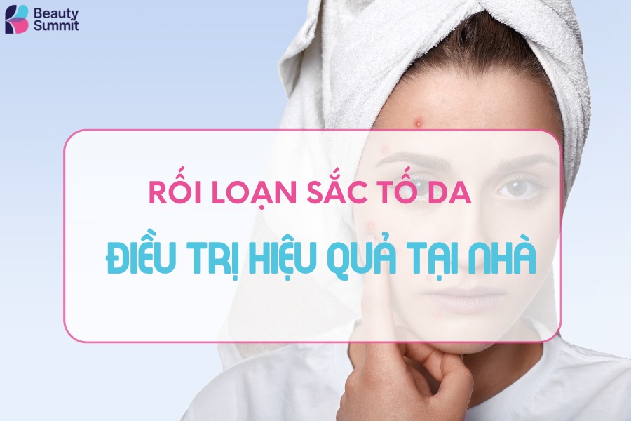 roi-loan-sac-to-da-33213
