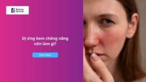 dị ứng kem chống nắng​