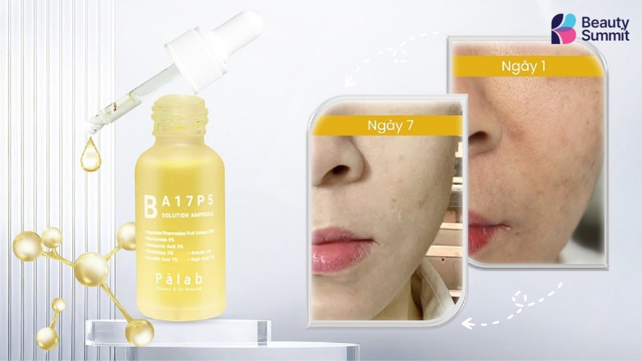 cach lam trang da bang kem danh rang 7