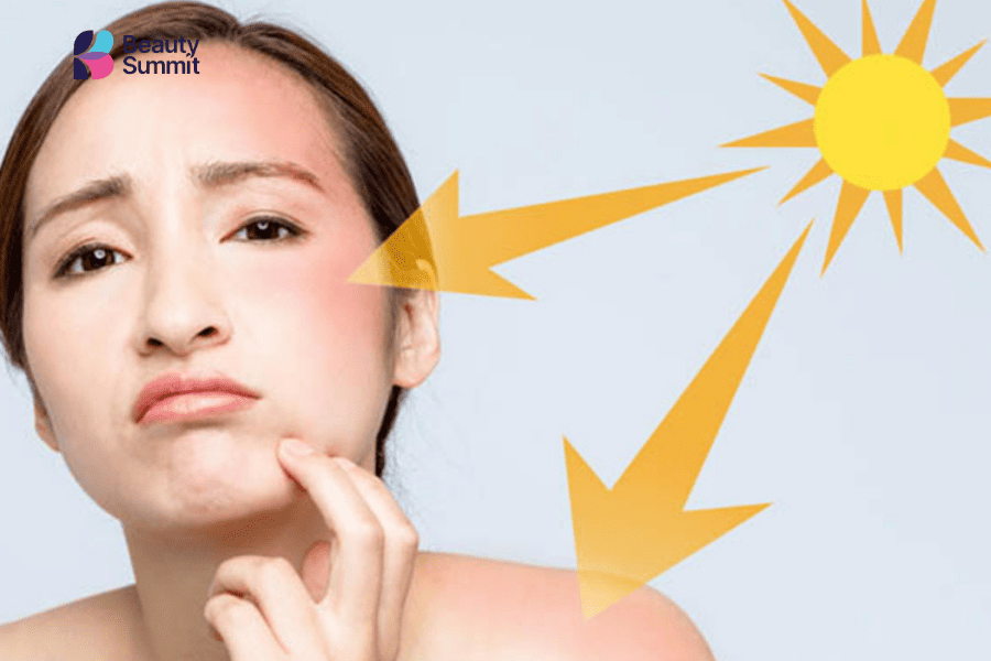 nắng sáng có làm đen da không